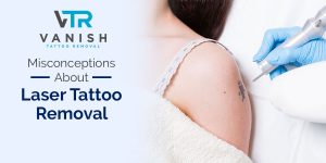 Misconceptions-About-Laser-Tattoo-Removal