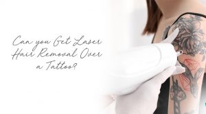 Can-you-Get-Laser-Hair-Removal-Over-a-Tattoo